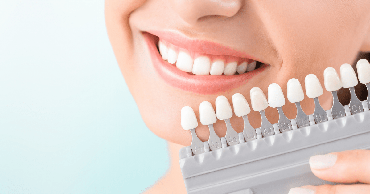 Elevate Your Confidence with Nubeam’s Teeth Whitening Innovations